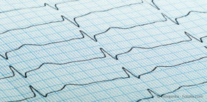 cardiogram of heart beat